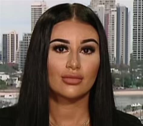 mikaela testa before surgery|Mikaela Testa Goes Back And Forth On Plastic Surgery Claims